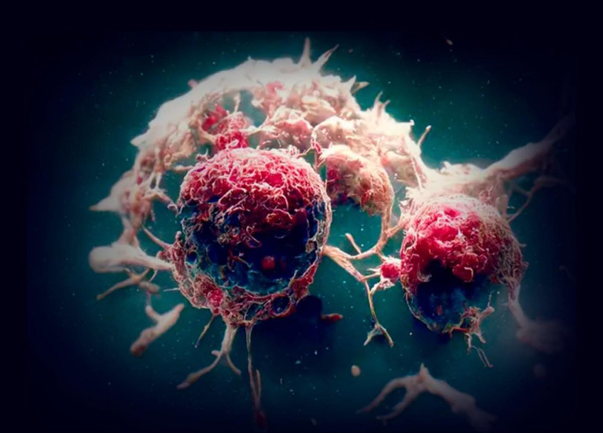 Descubren un tratamiento que ataca el ADN rebelde del cáncer más agresivo para detener su avance.