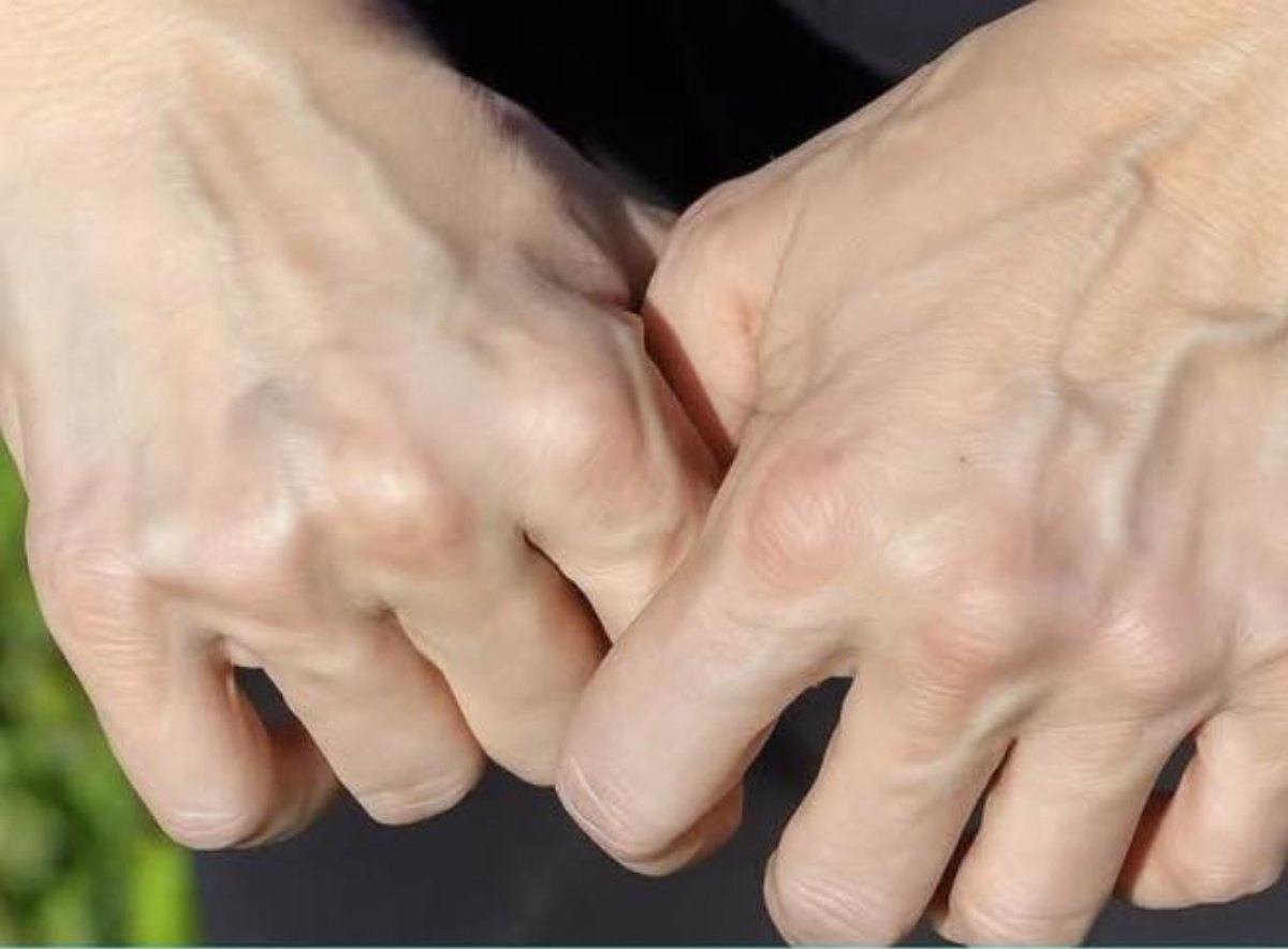Por Qué Algunas Personas Tienen las Venas de las Manos Muy Marcadas? Descúbrelo Aquí.