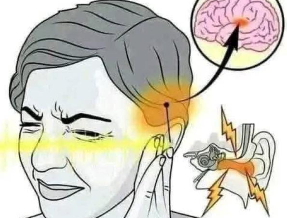 Tinnitus ¿Cuáles son sus causas?