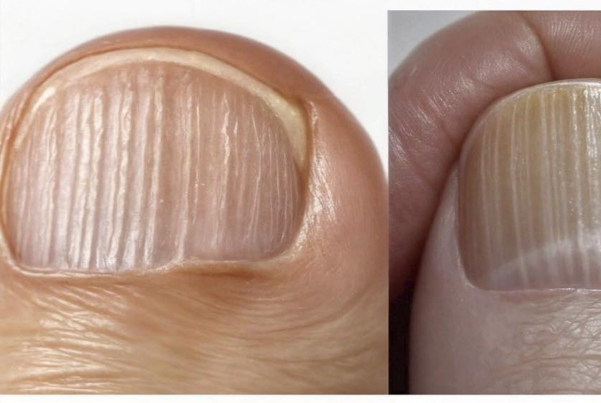 ¿Tienes líneas en las uñas? debes solucionarlo