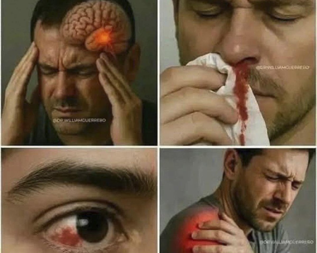 Dolores de cabeza fuertes y sangrado nasal: posibles causas y señales de alerta