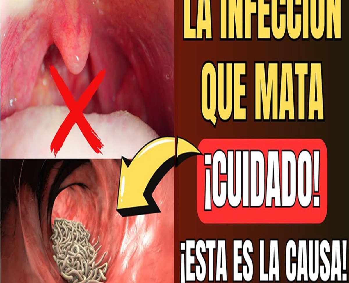 La PELIGROSA CAUSA de la FLEMA TÓXICA PERSISTENTE