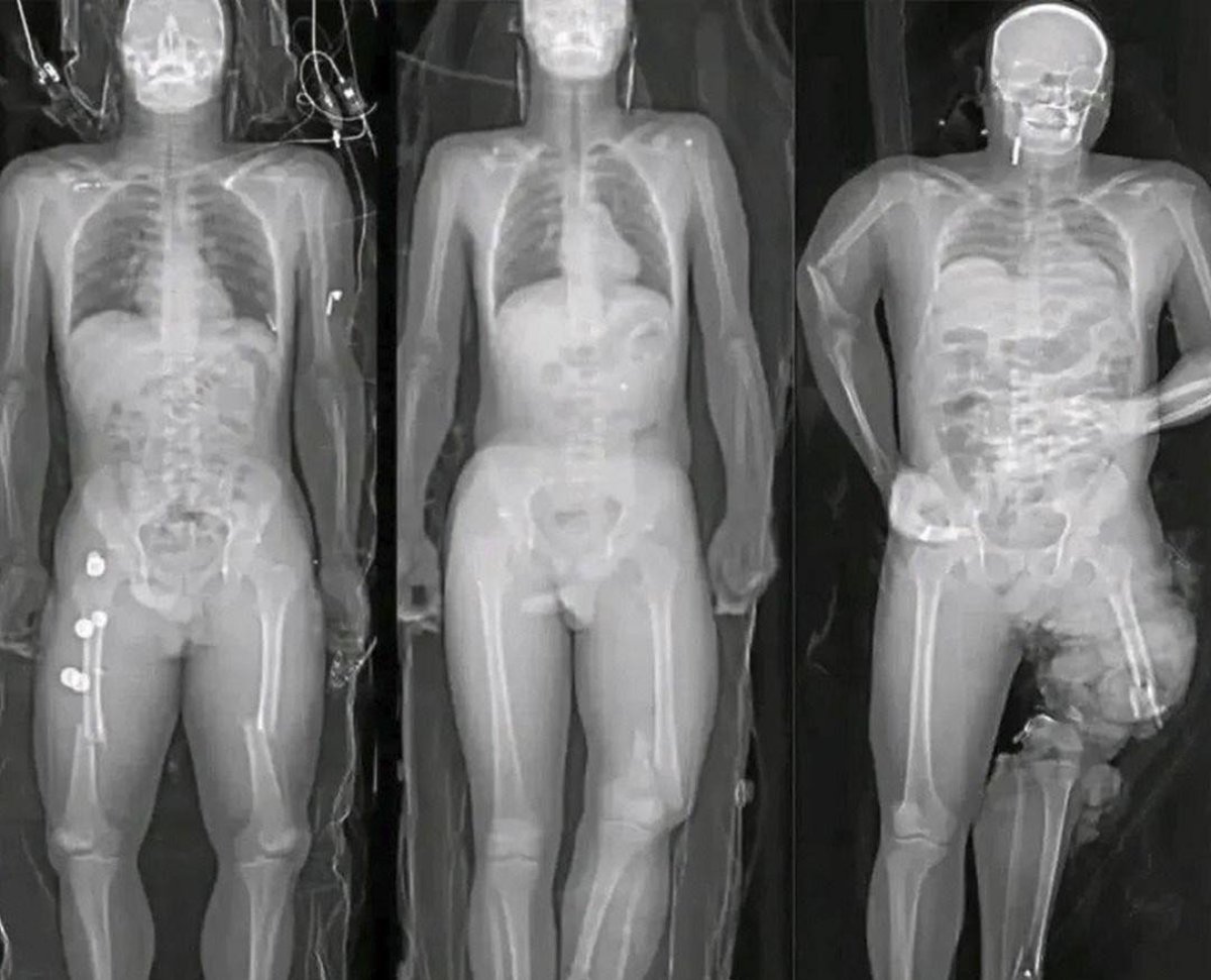 Si te pusiste la vacuna del COVID debes saber esto