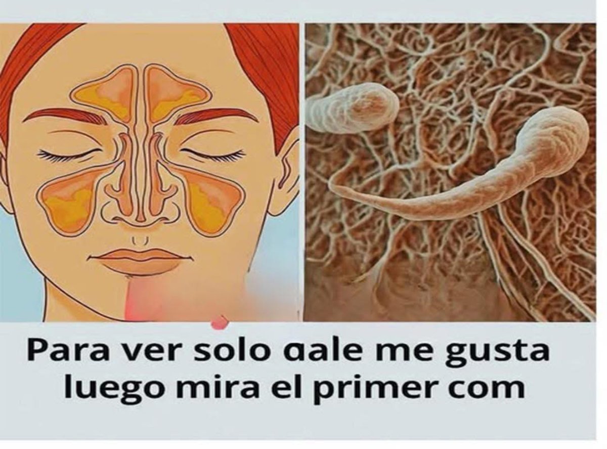 Elimina el moco, la flema en la garganta y nariz, y dile adiós a la rinitis de forma natural