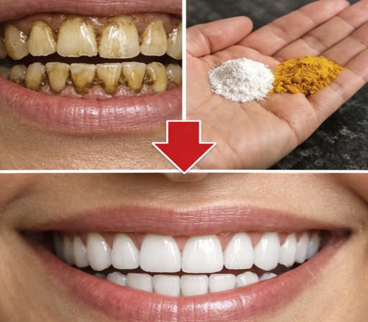 Cómo blanquear los dientes y prevenir las caries de forma natural: trucos y consejos que realmente funcionan