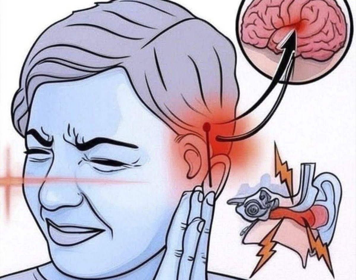 El zumbido en el oído y su impacto en tu salud