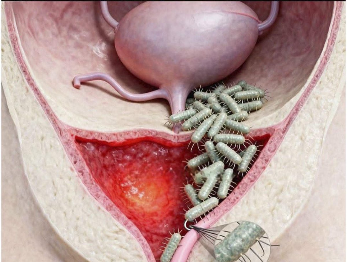 Por qué es importante orinar después de tener relaciones