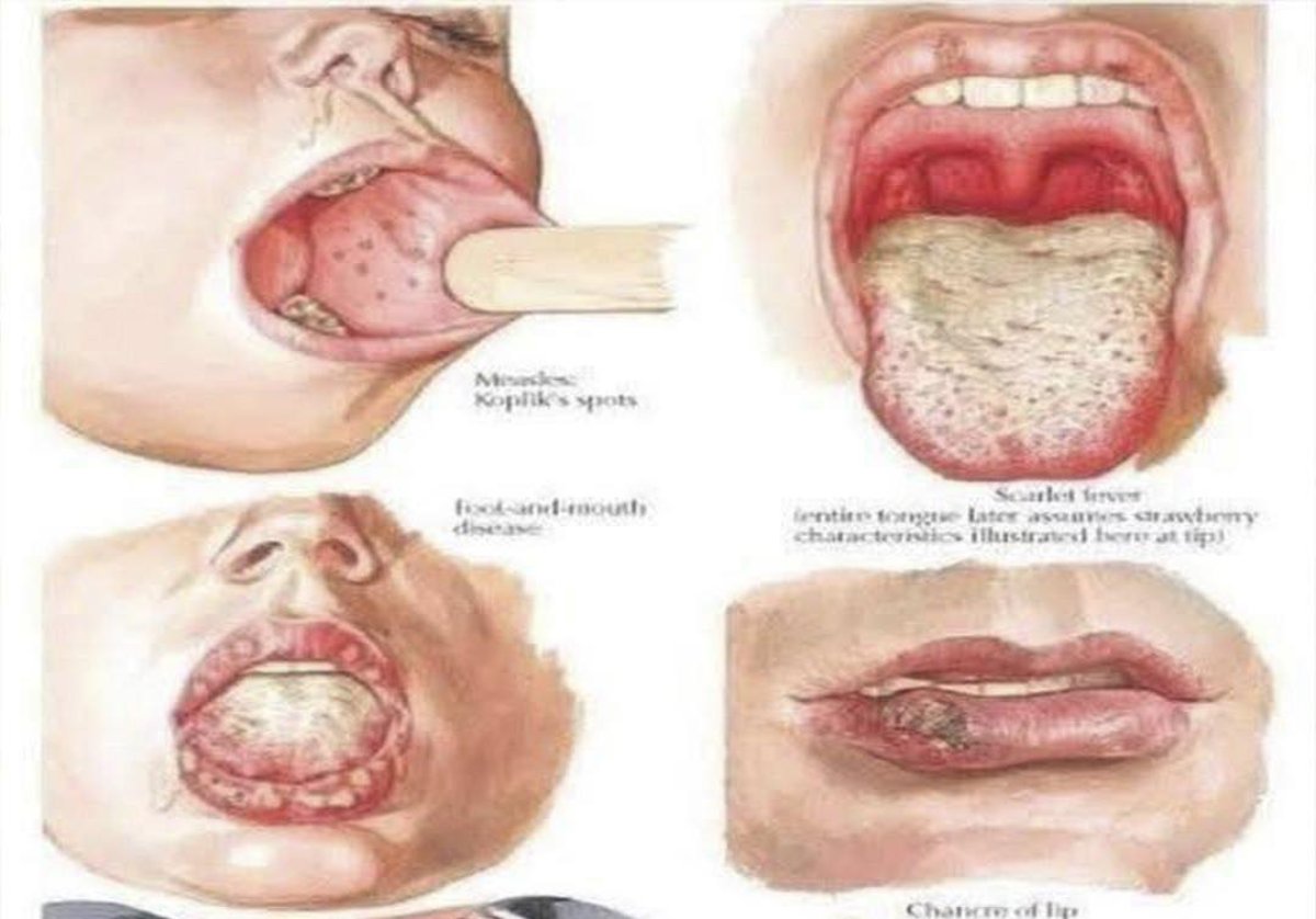 Signos en la boca: lo que tu salud quiere decirt