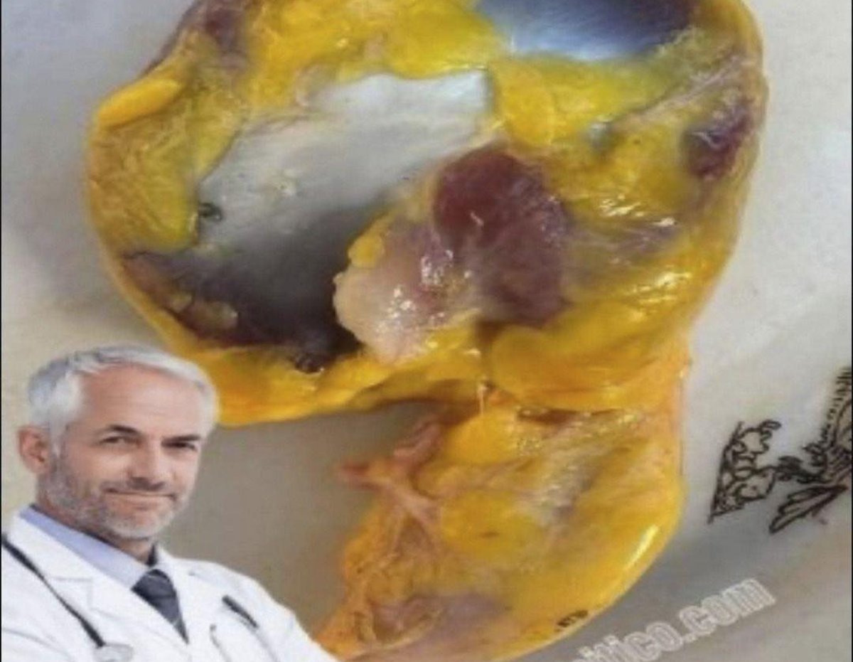 Por qué deberías comer mollejas de pollo ya mismo: un tesoro olvidado en tu cocina