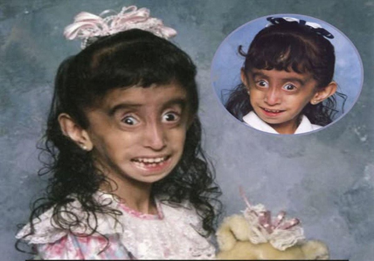 De víctima a inspiración: Lizzie Velásquez y su poderosa lección a los haters