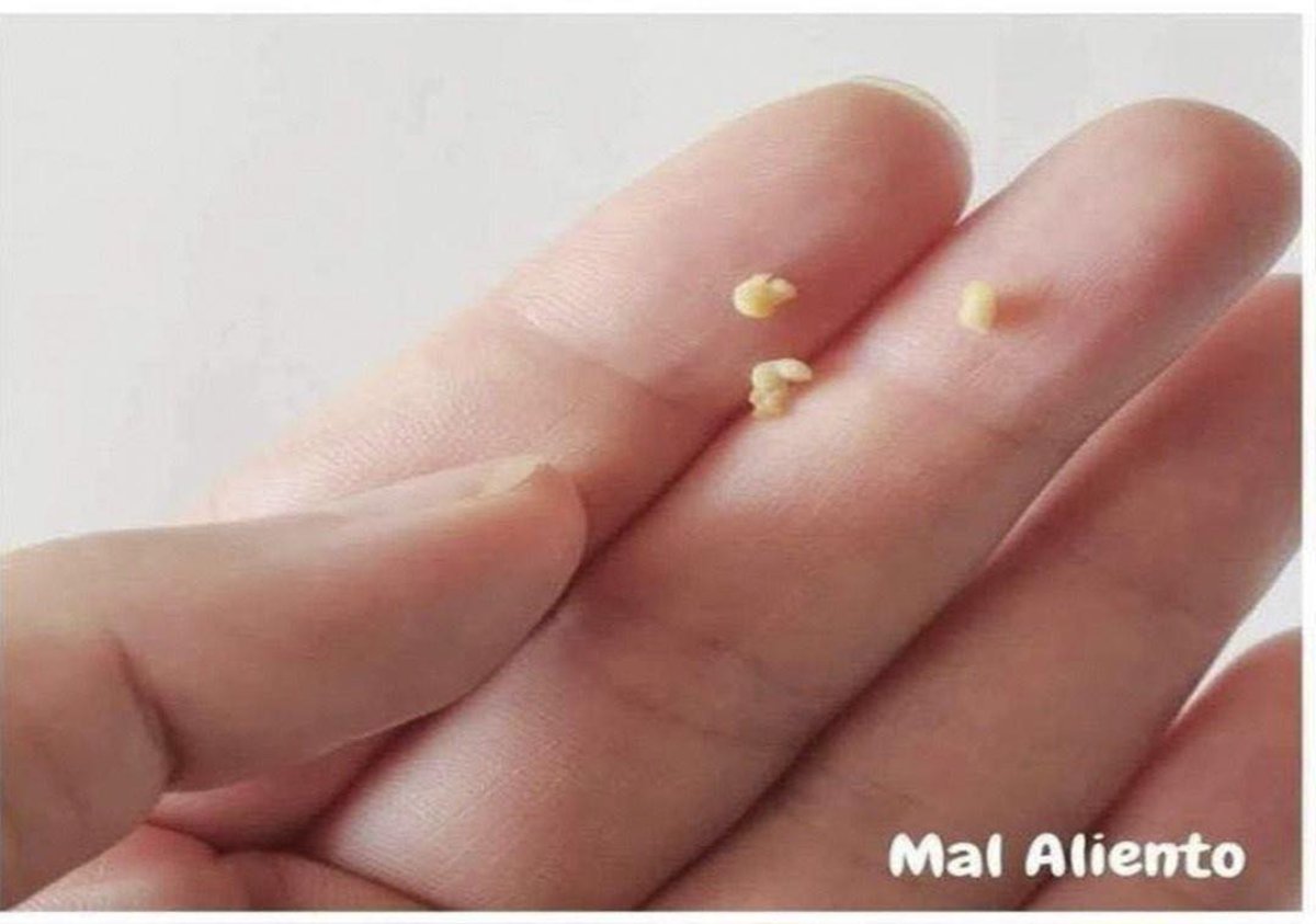 Mi boca huele muy mal: causas y soluciones