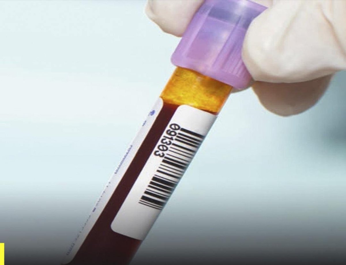 ¿Podría tu tipo de sangre estar marcando la velocidad con que envejeces? Lo que dice la ciencia