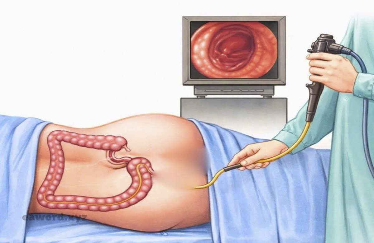 Las 5 Pruebas de Salud Que Debes Evitar Después de los 70 Años (Y Por Qué)