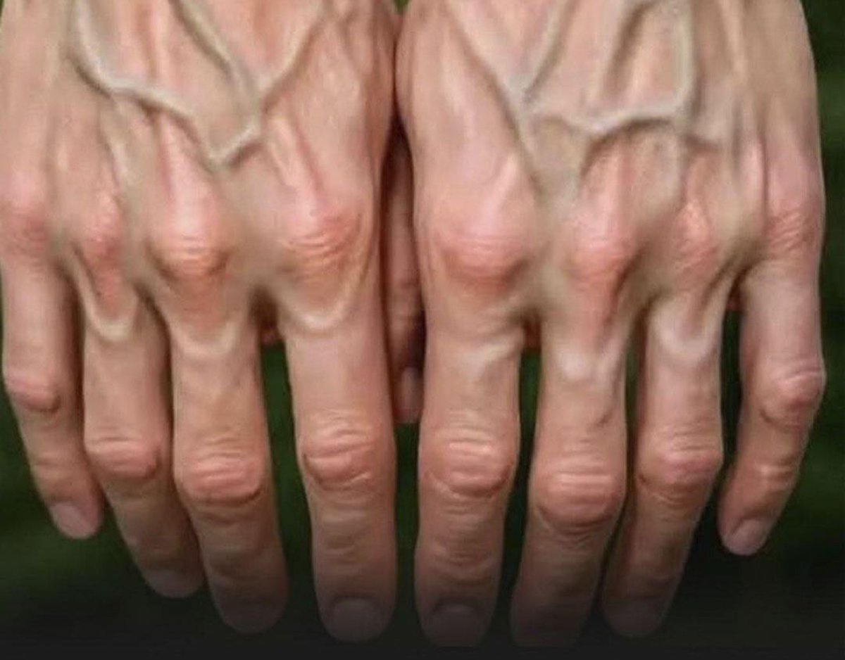 ¿Tus venas se ven más de lo normal? Esto es lo que tu cuerpo podría estar tratando de decirte