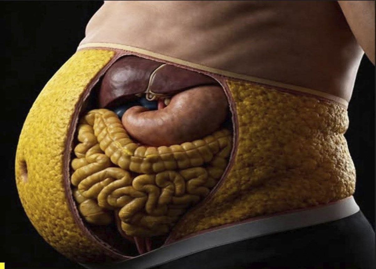 ¿Por qué se te acumula grasa en la barriga?