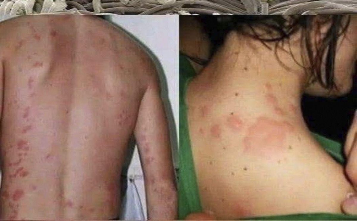 Elimina los millones de ácaros que se acumulan en el colchón: lo que debes saber y cómo librarte de ellos