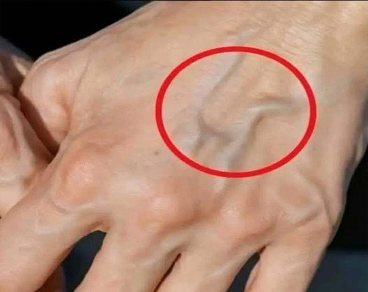 Protuberancias en las manos: una señal que tu cuerpo no debes ignorar