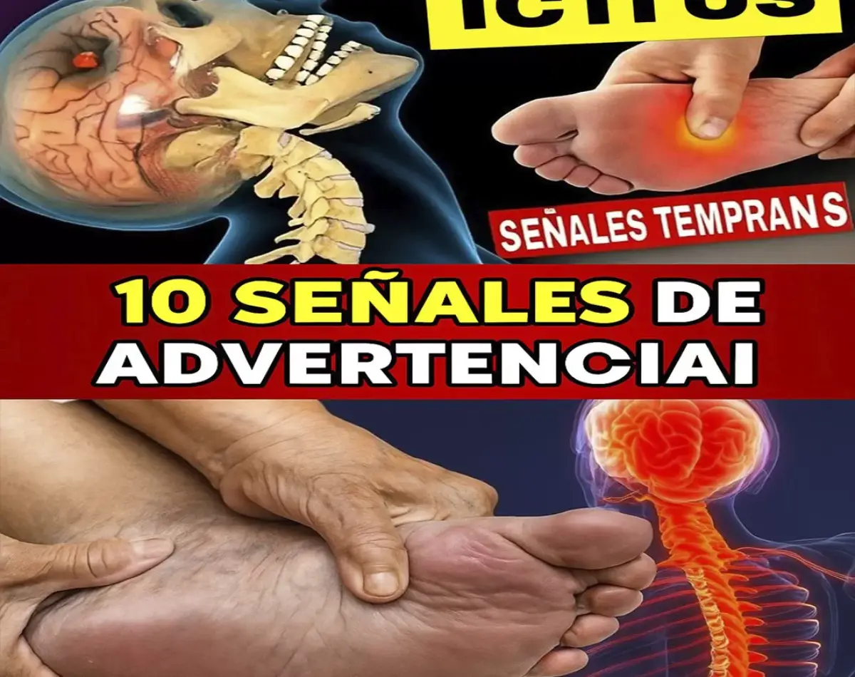 10 señales que podrían avisarte de un derrame cerebral – incluso semanas antes